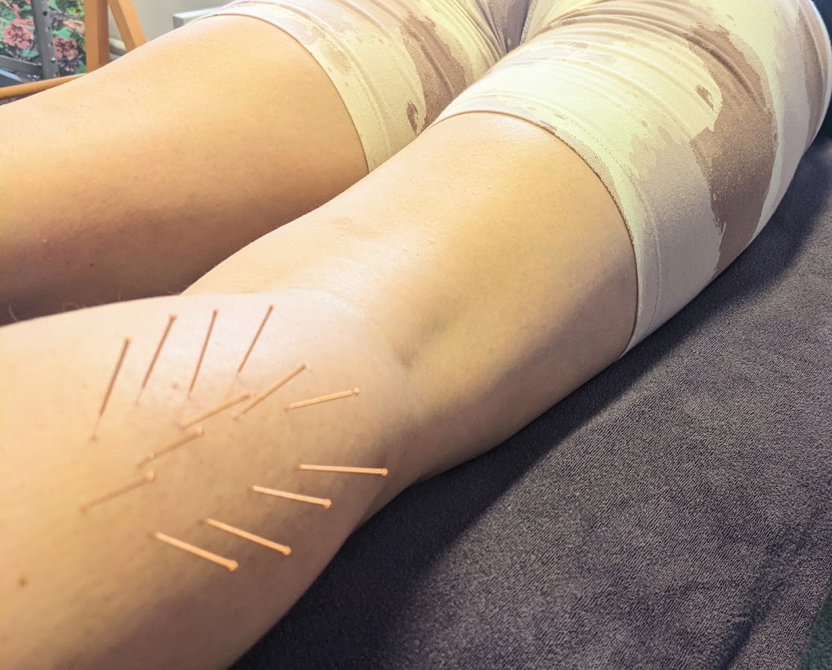 Ellen Gingell Remedial/Sports and Lymphatic Drainage massage